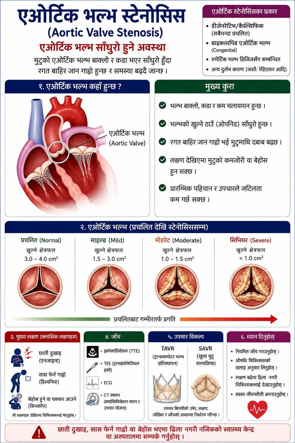 एओर्टिक भल्भ स्टेनोसिस