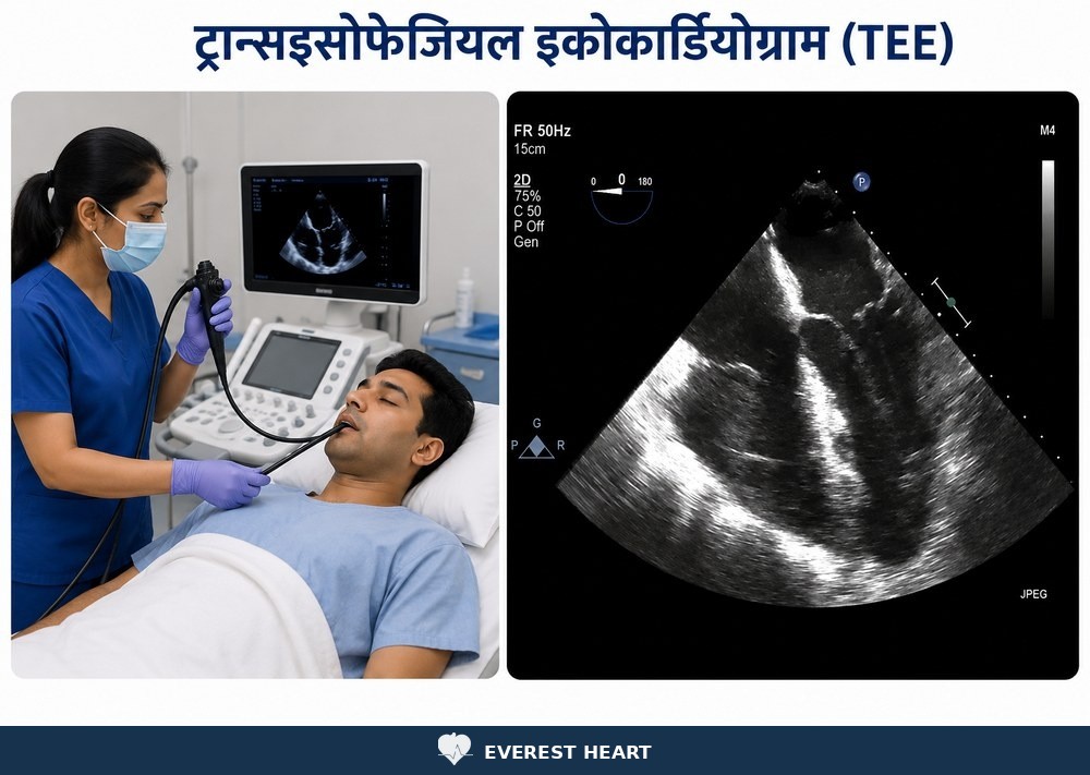 ट्रान्सइसोफेजियल इकोकार्डियोग्राम (TEE) प्रक्रिया